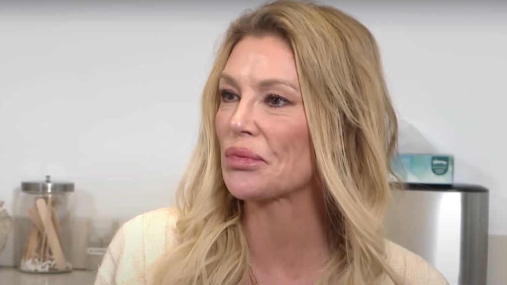 Brandi Glanville Share Details of Face 'Parasite'