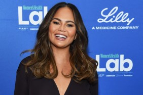 Why Fans Think Chrissy Teigen Got Face Surgery
